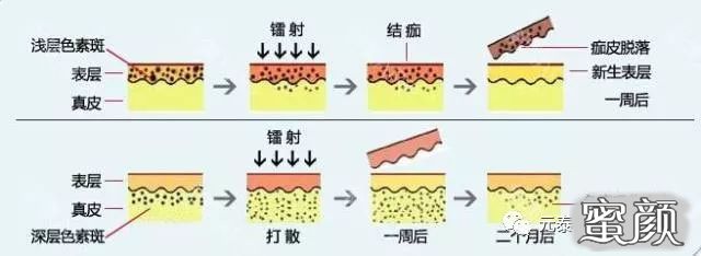 https://img.miyanlife.com/mnt/timg/210327/21493L3X-4.jpg