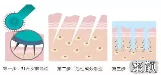https://img.miyanlife.com/mnt/timg/210330/142HJ955-5.jpg