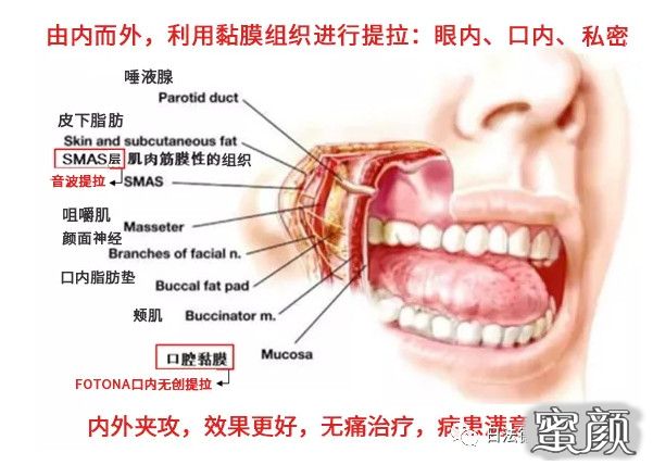 案例图片