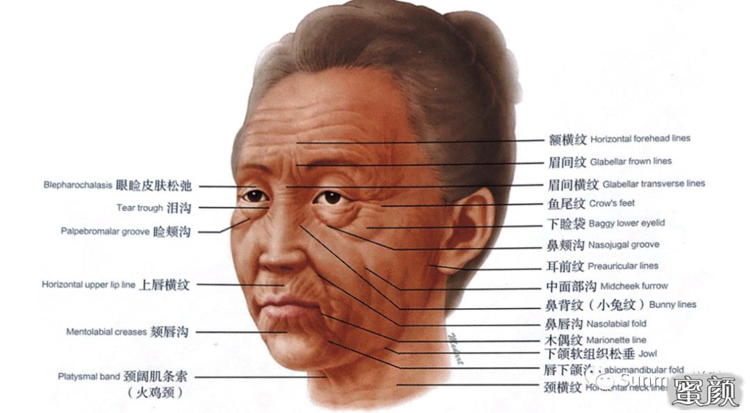 https://img.miyanlife.com/mnt/timg/210403/2140516328-1.jpg