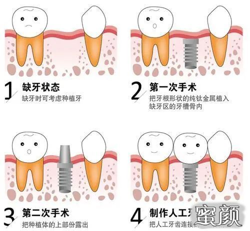 案例图片