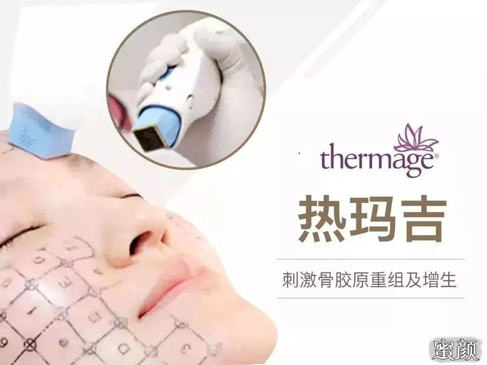 https://img.miyanlife.com/mnt/timg/210409/10345C328-0.jpg