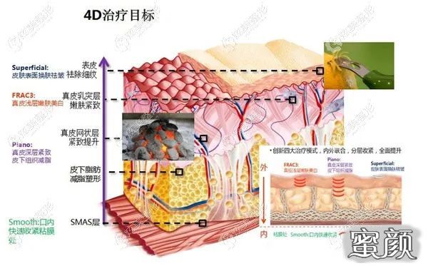 案例图片