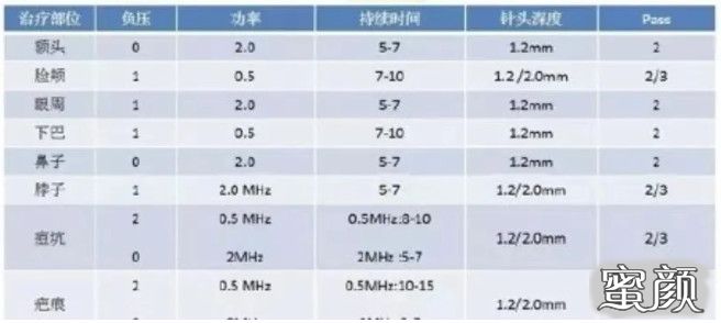 https://img.miyanlife.com/mnt/timg/210409/21113U530-3.jpg