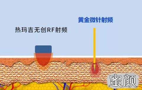 https://img.miyanlife.com/mnt/timg/210409/2111404A8-5.jpg