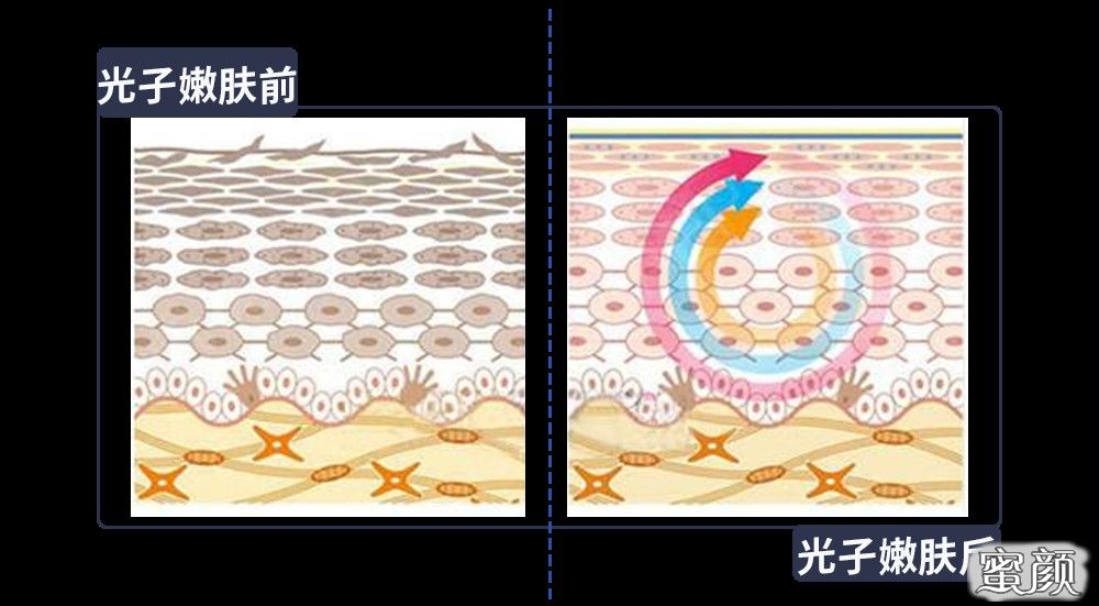 案例图片