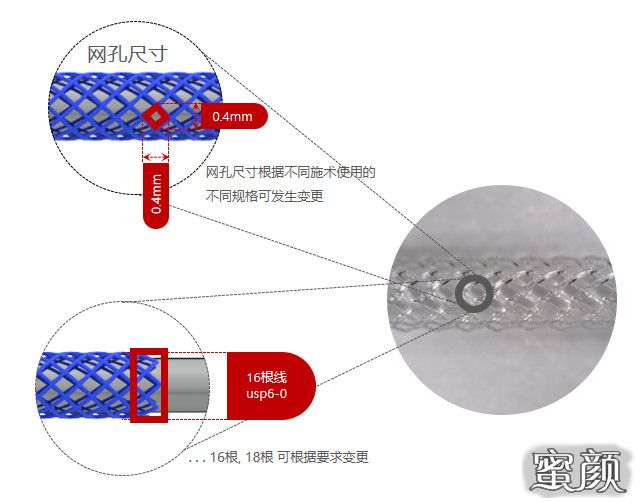 案例图片