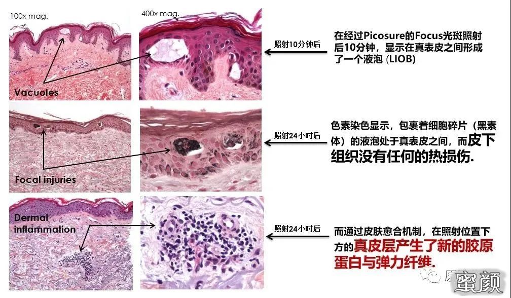 https://img.miyanlife.com/mnt/timg/210413/203Z43V5-5.jpg