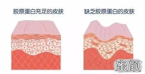 https://img.miyanlife.com/mnt/timg/210416/15111552J-1.jpg