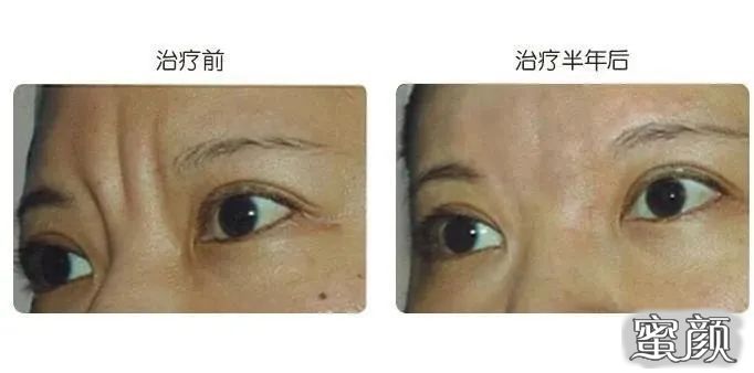 https://img.miyanlife.com/mnt/timg/210416/15112145a-5.jpg