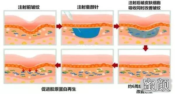 https://img.miyanlife.com/mnt/timg/210416/1511216306-3.jpg