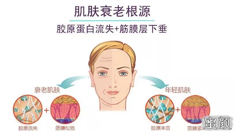https://img.miyanlife.com/mnt/timg/210416/202U36454-0.jpg