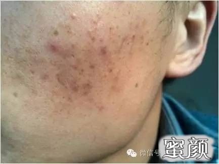 https://img.miyanlife.com/mnt/timg/210416/21515161K-7.jpg