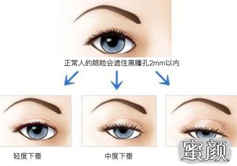 https://img.miyanlife.com/mnt/timg/210418/120S91326-6.jpg