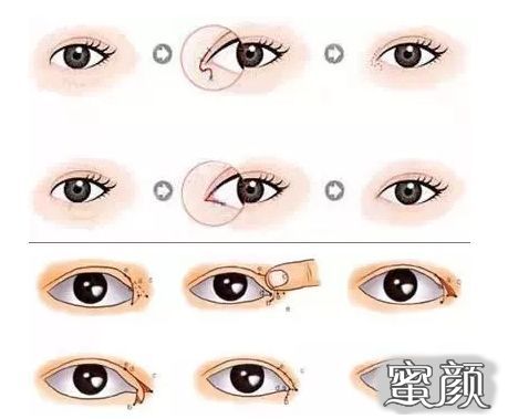 https://img.miyanlife.com/mnt/timg/210418/120S913M-5.jpg