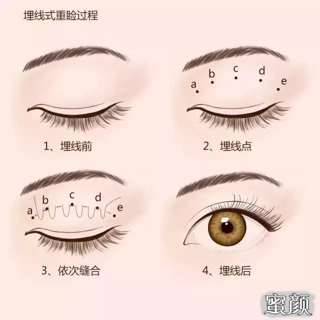 https://img.miyanlife.com/mnt/timg/210418/120SQH9-2.jpg