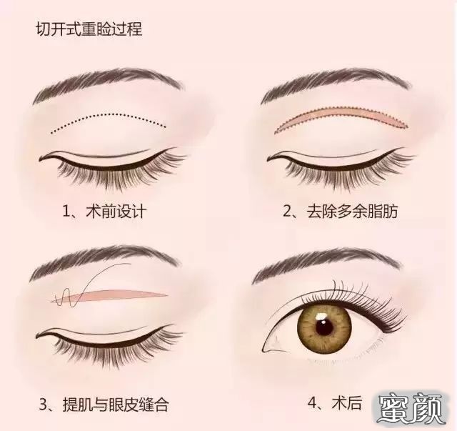 https://img.miyanlife.com/mnt/timg/210418/120SS961-4.jpg