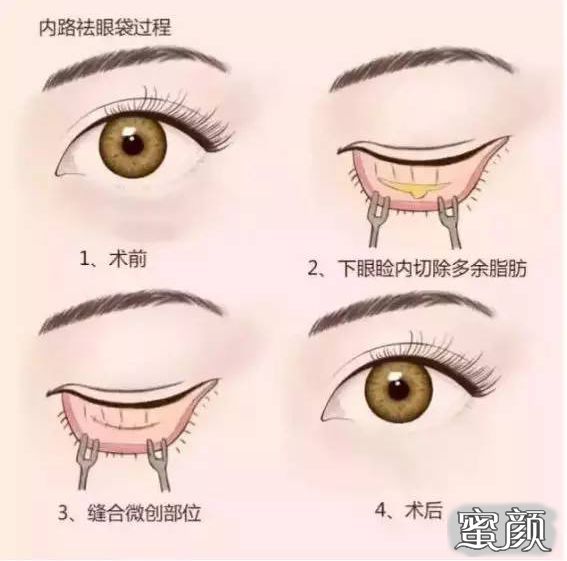 https://img.miyanlife.com/mnt/timg/210418/120T02P0-9.jpg
