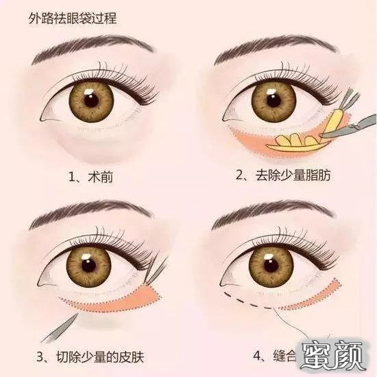 https://img.miyanlife.com/mnt/timg/210418/120T05917-11.jpg