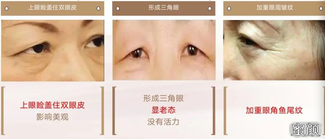 https://img.miyanlife.com/mnt/timg/210418/12305341a-0.jpg