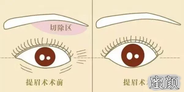 https://img.miyanlife.com/mnt/timg/210418/1231031552-4.jpg