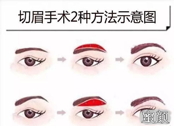 https://img.miyanlife.com/mnt/timg/210418/1231033634-3.jpg