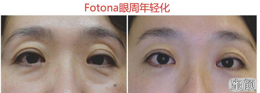 https://img.miyanlife.com/mnt/timg/210422/0K64L246-12.jpg