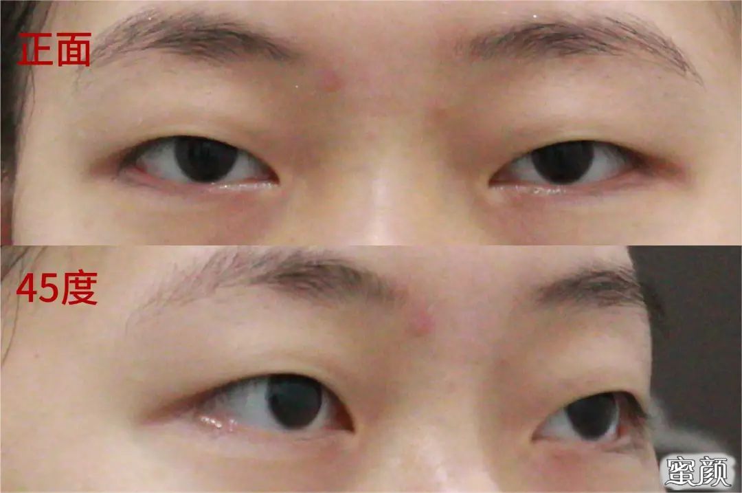 https://img.miyanlife.com/mnt/timg/210422/1300394O2-2.jpg
