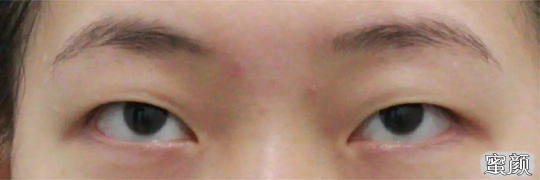 https://img.miyanlife.com/mnt/timg/210422/1300431F8-4.jpg