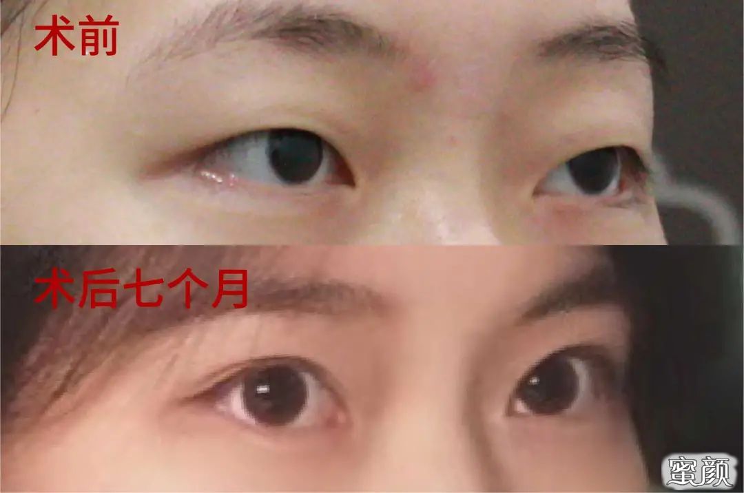https://img.miyanlife.com/mnt/timg/210422/1301045b5-15.jpg