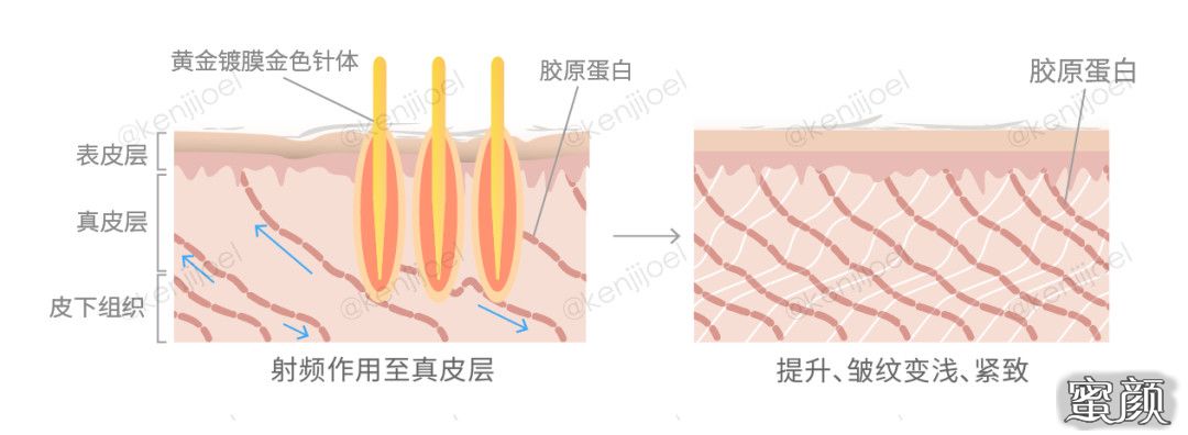 https://img.miyanlife.com/mnt/timg/210425/193J62534-1.jpg