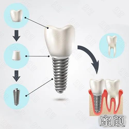 案例图片