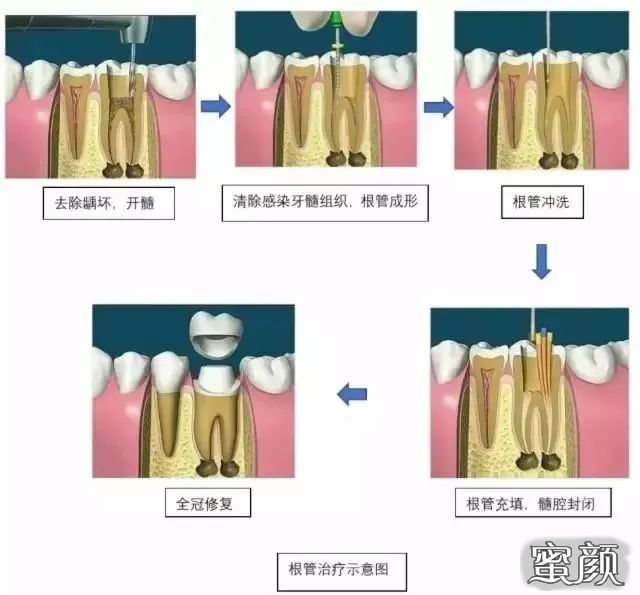 案例图片