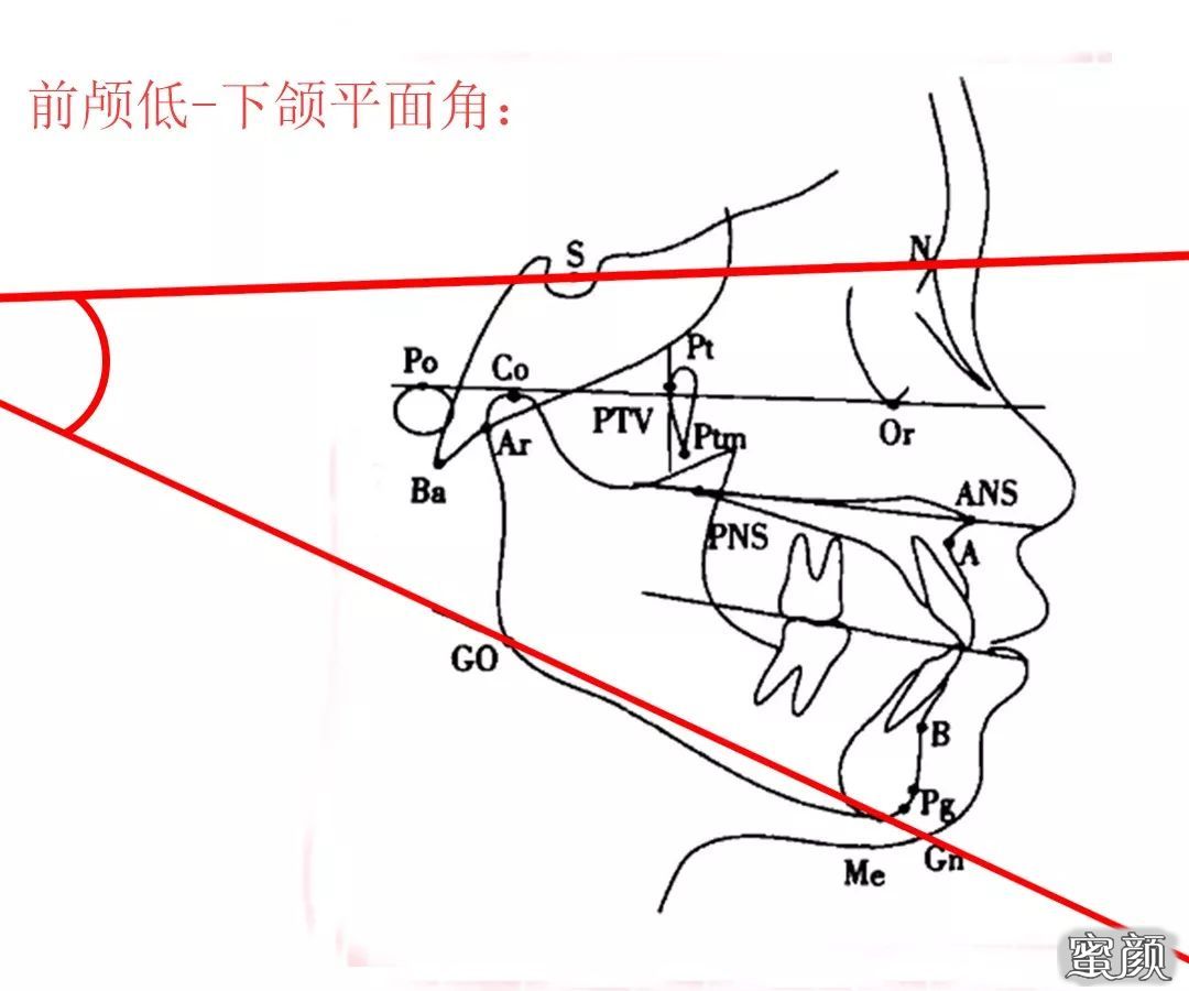 案例图片