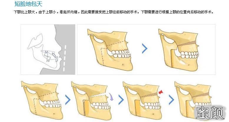 案例图片