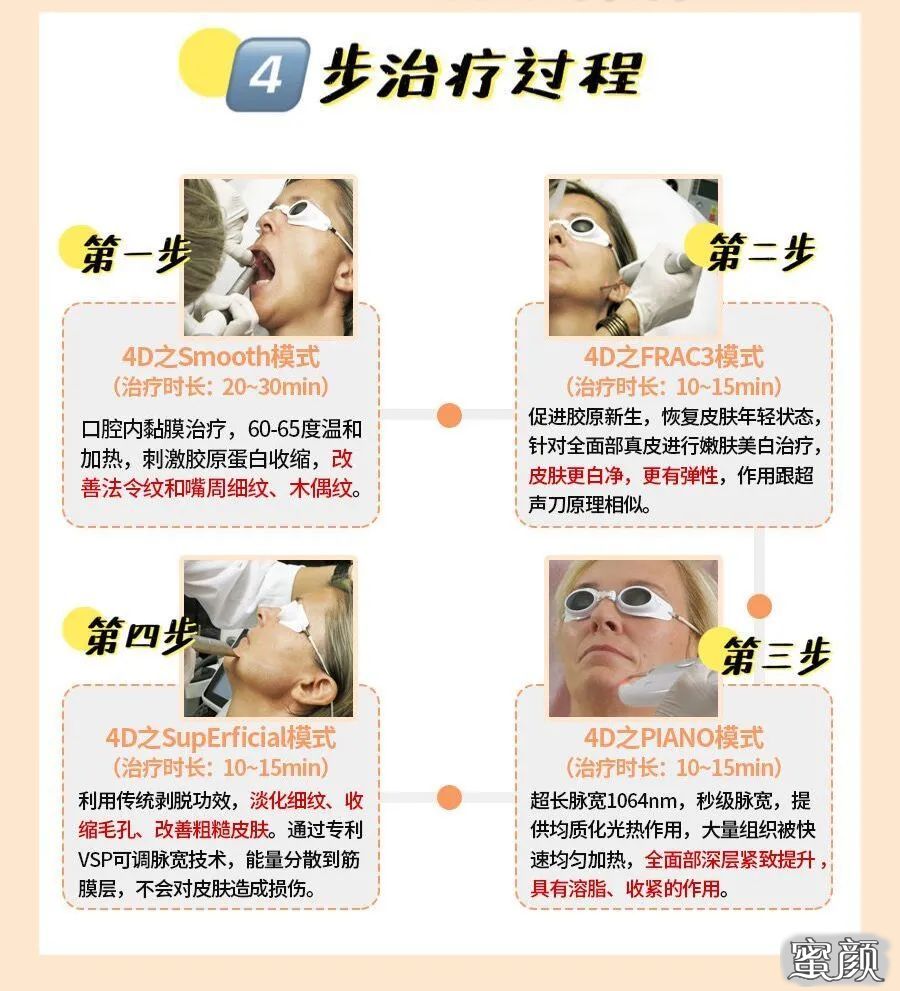 https://img.miyanlife.com/mnt/timg/210428/1S4531145-8.jpg
