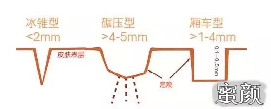 https://img.miyanlife.com/mnt/timg/210429/144633K52-0.jpg