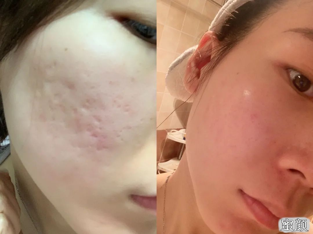 https://img.miyanlife.com/mnt/timg/210501/0016021222-1.jpg