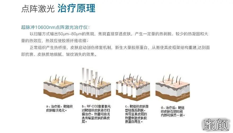 https://img.miyanlife.com/mnt/timg/210501/0016032J3-2.jpg