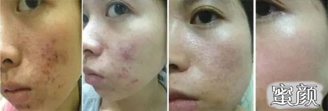 https://img.miyanlife.com/mnt/timg/210501/2053221600-1.jpg