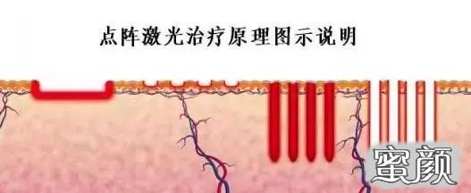 https://img.miyanlife.com/mnt/timg/210501/2053226492-0.jpg