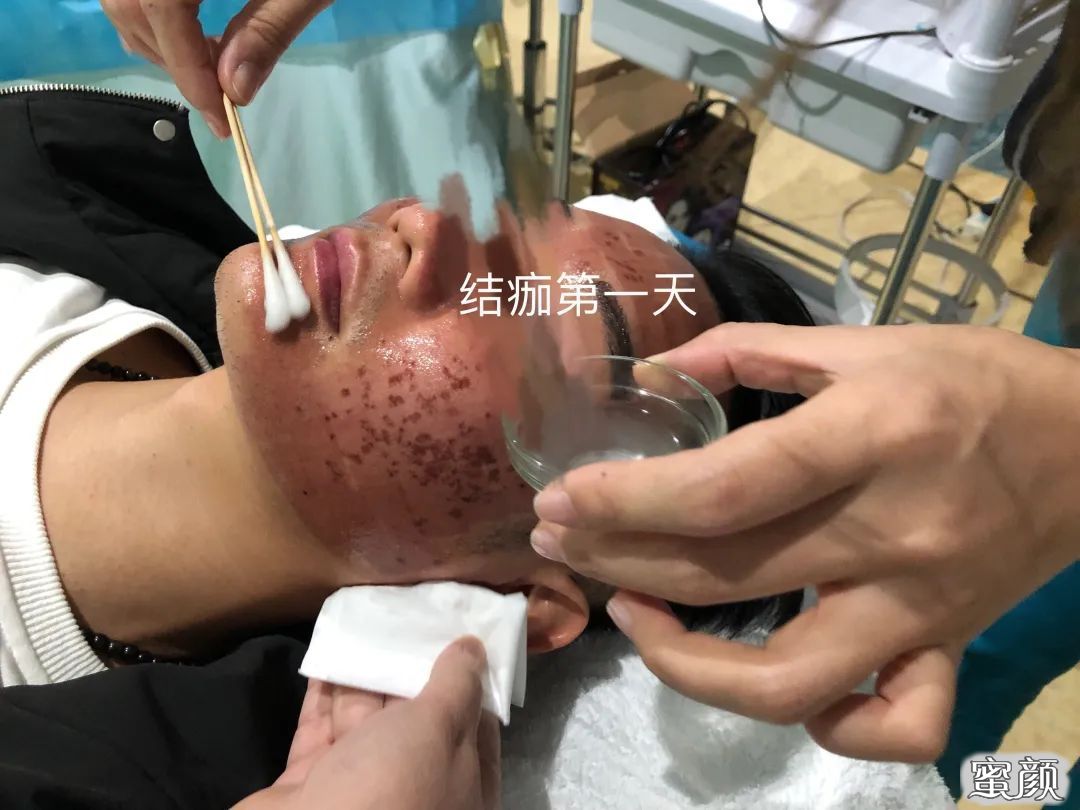 https://img.miyanlife.com/mnt/timg/210501/20532511J-3.jpg