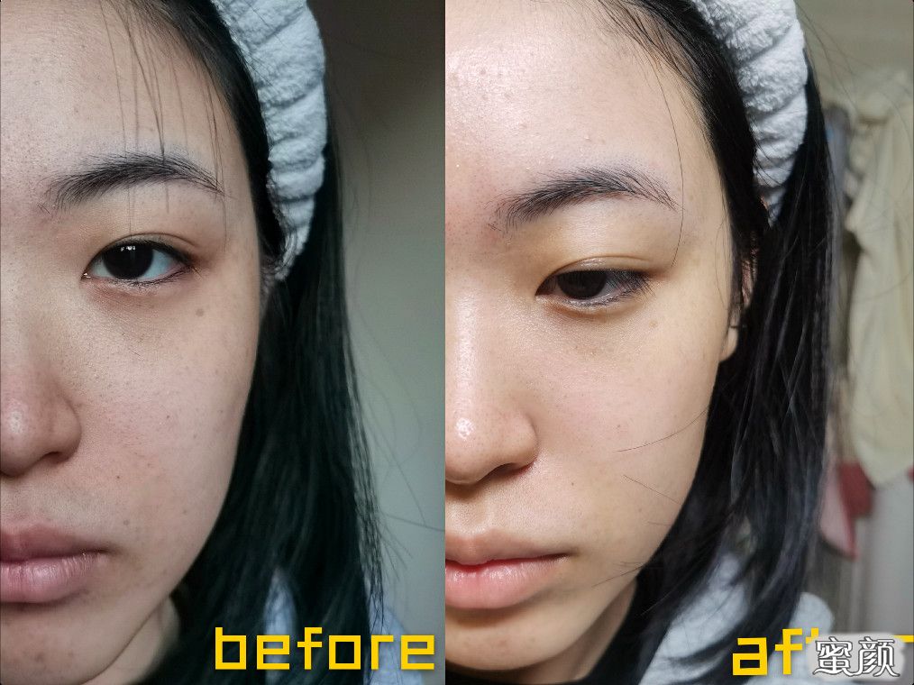 https://img.miyanlife.com/mnt/timg/210501/2159512F0-1.jpg