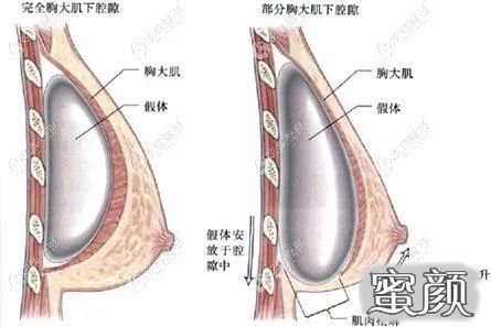 案例图片