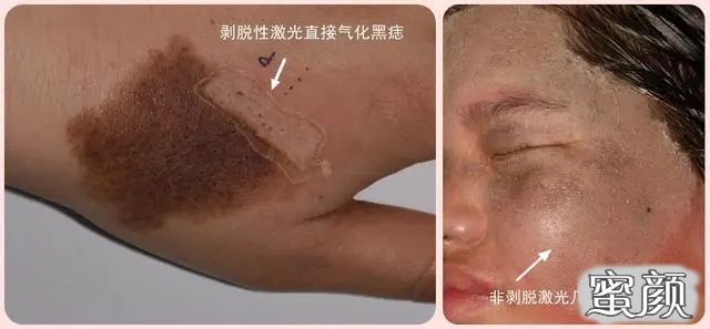 https://img.miyanlife.com/mnt/timg/210504/2134134061-7.jpg