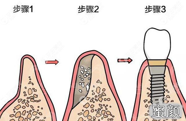 案例图片