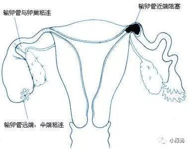 输卵管组织结构示意图图片