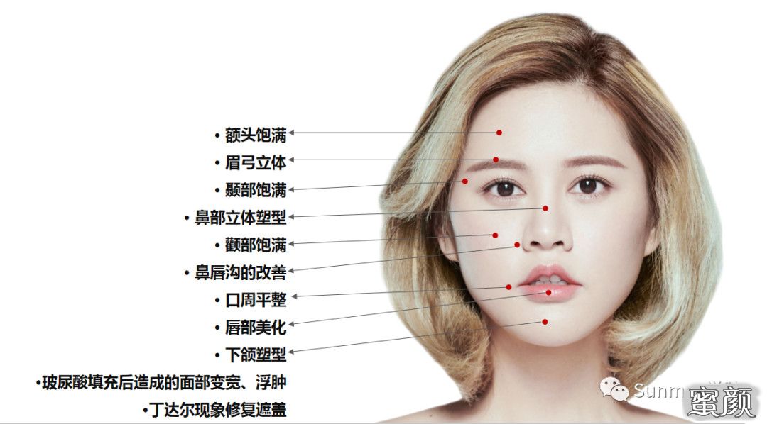 颧部图片