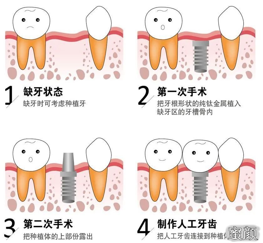 案例图片