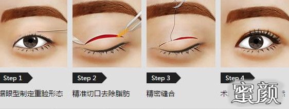 https://img.miyanlife.com/mnt/timg/210510/15223VS7-6.jpg